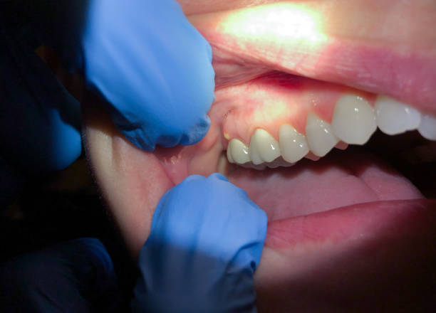 Best Urgent Care for Lost Fillings or Crowns in Bridgeville, PA